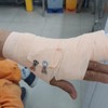Công an nêu lý do nhân viên điện lực bị đánh đứt gân ngón tay