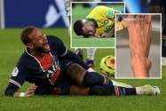 Neymar lên bàn mổ, nghỉ hết mùa giải