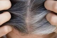 3 loại phụ liệu thực phẩm giúp ngăn ngừa tóc bạc sớm