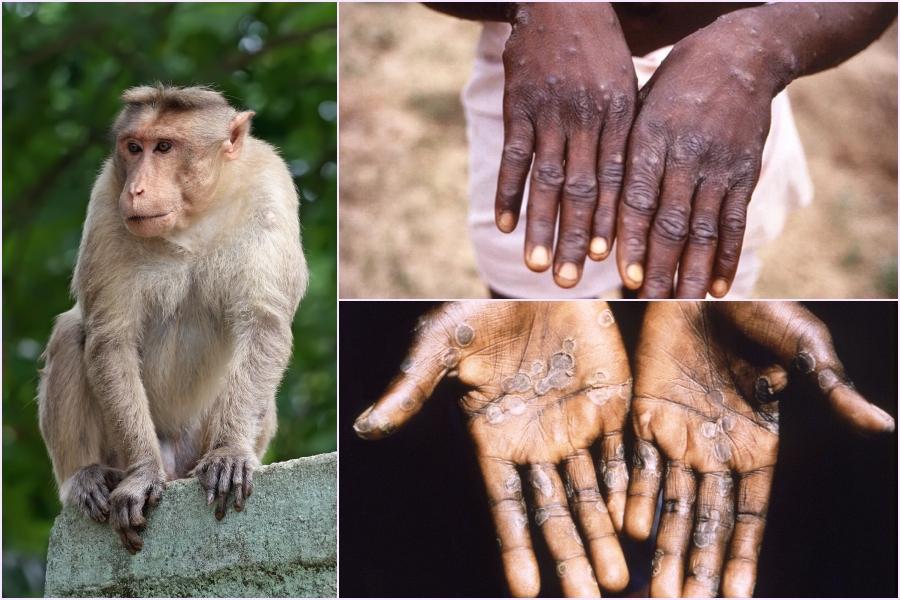 Những hình ảnh về bệnh đậu mùa khỉ sẽ giúp bạn hiểu rõ hơn về căn bệnh này và cách phòng chống nó. Ngoài ra, xem các hình ảnh này cũng giúp bạn có kiến thức về thế giới y tế và cách bảo vệ bản thân.