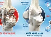 Coi chừng viêm khớp tự miễn hậu COVID-19