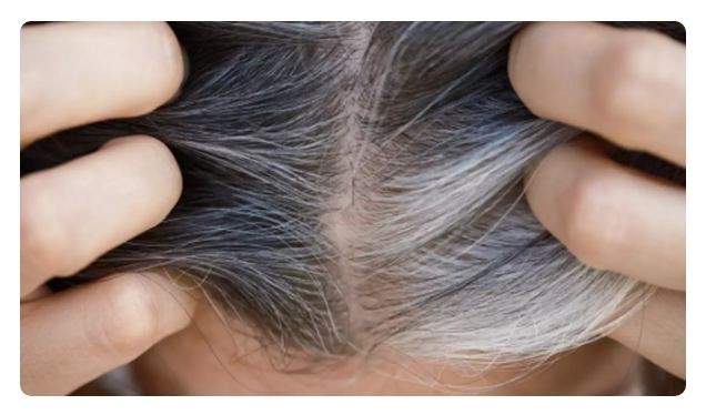 3 loại phụ liệu thực phẩm giúp ngăn ngừa tóc bạc sớm ảnh 1
