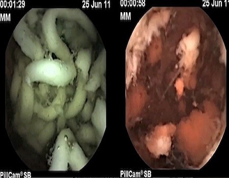 Mì ăn liền nguy hại hơn bạn tưởng ảnh 1