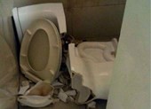 Mông bị cắt sâu do ngồi xổm làm sập bồn cầu