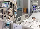 Ong vò vẽ tấn công: 2 người chết, 2 người nguy kịch