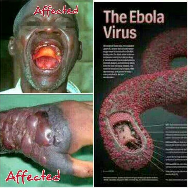 10 thắc mắc không thể bỏ qua về bệnh dịch chết người Ebola