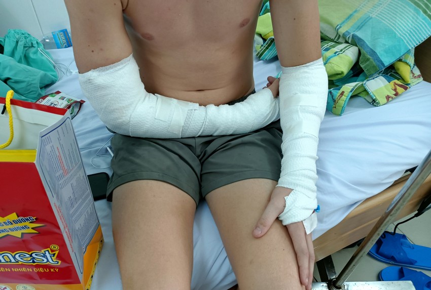 Công an TP Nha Trang thụ lý vụ chó cắn du khách nước ngoài