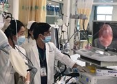 Người nhà khai bé hóc đậu phộng, bác sĩ gắp ra hạt mãng cầu