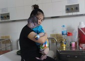 Mẹ mắc thủy đậu có được cho con bú?