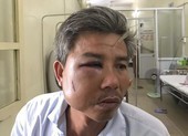 Nhân viên Trung tâm công viên cây xanh bị đánh nhập viện