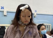 Nhóm 4 cô gái kể lý do bị hành hung trong quán nhậu ở Thủ Đức