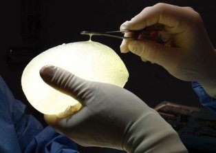 Anh điều tra vụ túi ngực PIP có khả năng gây ung thư ảnh 1