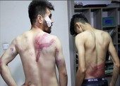 Taliban bị cáo buộc đánh đập các nhà báo Afghanistan
